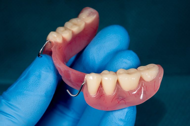 Comparison of acrylic and metal removable dentures
