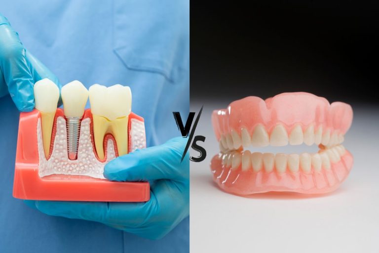 استحکام ایمپلنت و دندان مصنوعی