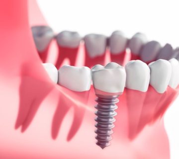 پارسیل دندان