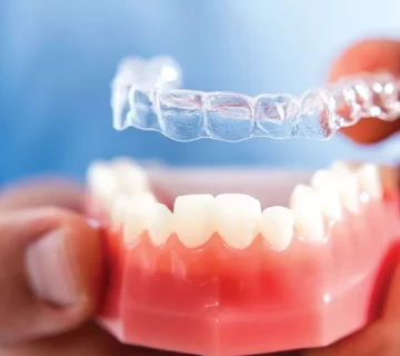 ارتودنسی نامرئی