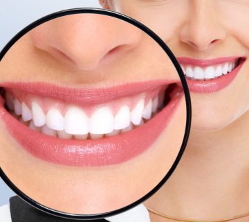 عوارض بلیچینگ