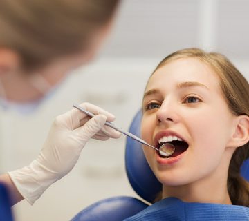 فیشورسیلانت دندان