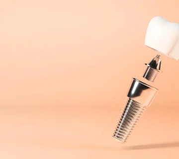 فیکسچر ایمپلنت