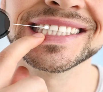 جویدن با دندان ایمپلنت چگونه است؟