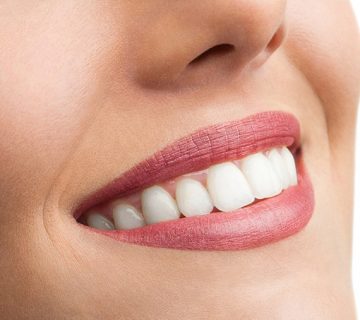 ترمیم با کامپوزیت یک روش محبوب و پرکاربرد در دندانپزشکی ترمیمی و زیبایی است. این روش با استفاده از مواد همرنگ دندان، نقص‌های ظاهری و ساختاری را اصلاح می‌کند.