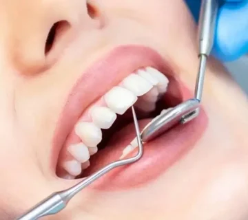 دندانپزشکی اقساطی با دیجی پی کرج