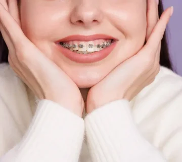 ارتودنسی اقساطی کرج