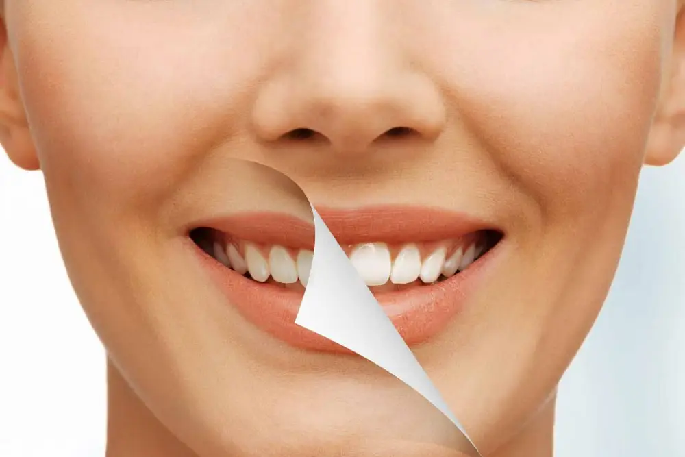 روشهای پرداخت هزینه دندانپزشکی اقساطی کرج