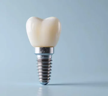 بهترین برند ایمپلنت دندان